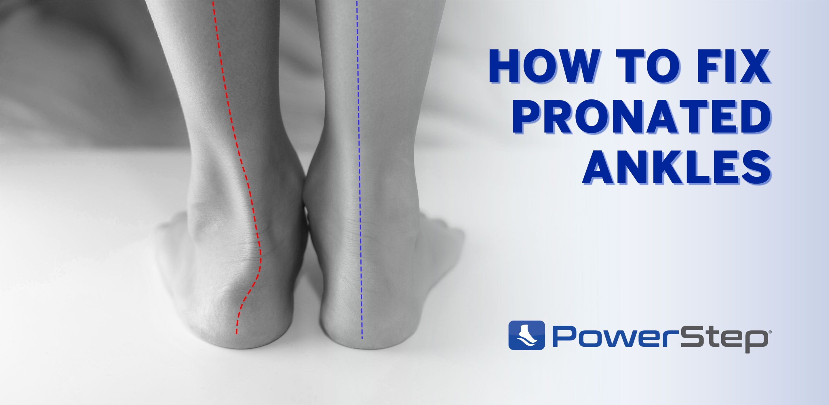 How to Fix Pronated Ankles: Insoles & Treatment Options – PowerStep