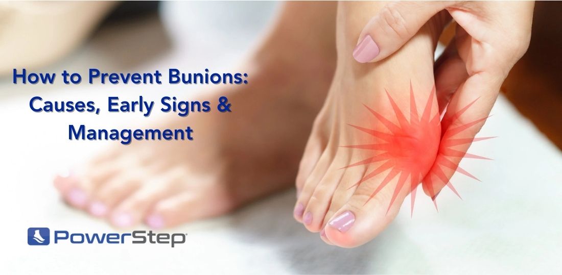 A foot with a painful bunion spot