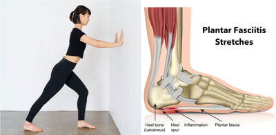 What Is Plantar Fasciitis? | Symptoms, Causes, and Stretches Explained