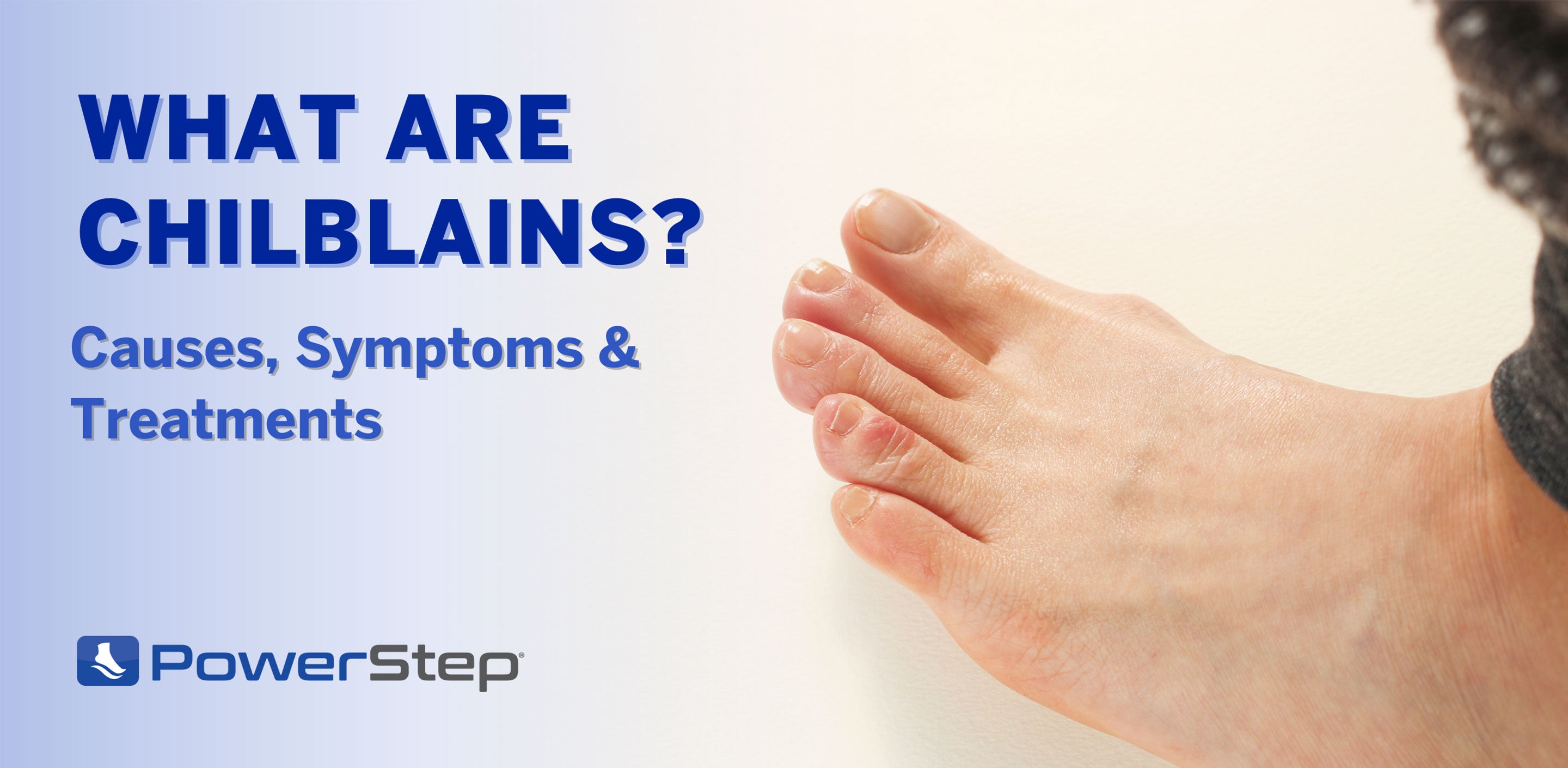 What are Chilblains? Causes, Symptoms & Treatment by PowerStep