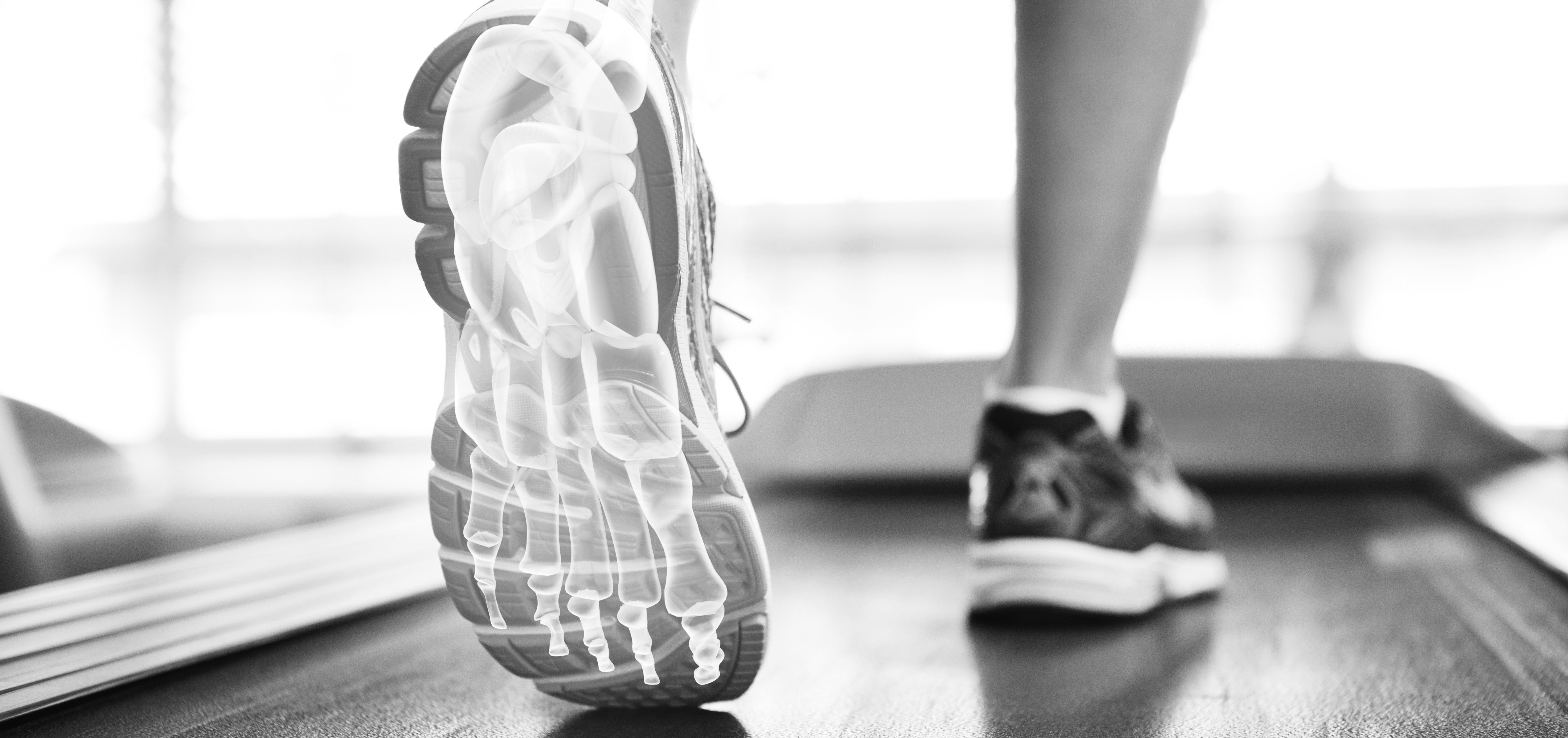 Insoles for Flat Feet, Fallen Arches, & Pronation – PowerStep